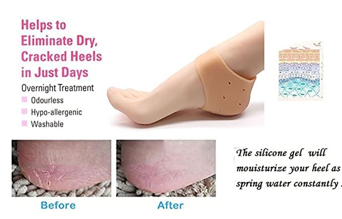 Silicone Gel Heel Pad Socks For Heel Swelling Pain Relief