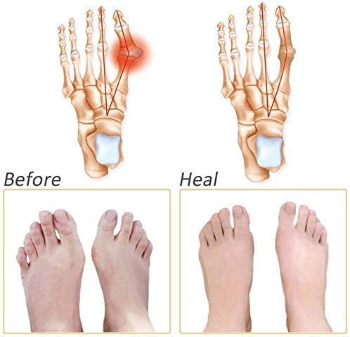 Silicone Gel Half Toe Sleeve Anti-Skid Forefoot Soft Pads for Pain Relief heel front socks silicone Heel Protector foot Gel Socks for Repair Dry Cracked Skins