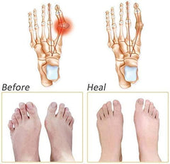 Silicone Gel Half Toe Sleeve Anti-Skid Forefoot Soft Pads for Pain Relief heel front socks silicone Heel Protector foot Gel Socks for Repair Dry Cracked Skins