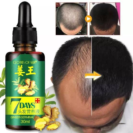 7 Day Ginger Germinal Serum Essence Oil Loss Treatment Growth Hair,Ginger Germinal Oil, Ginger Hair Growth Serum, Ginger Essential Oil