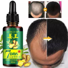 7 Day Ginger Germinal Serum Essence Oil Loss Treatment Growth Hair,Ginger Germinal Oil, Ginger Hair Growth Serum, Ginger Essential Oil