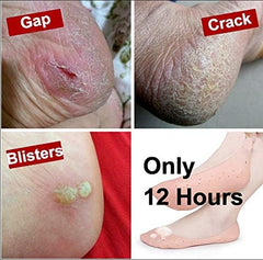 Unisex Silicon Full Length Moisturizing Socks for Foot Care and Heel Cracks Foot Protection with Breathable Holes
