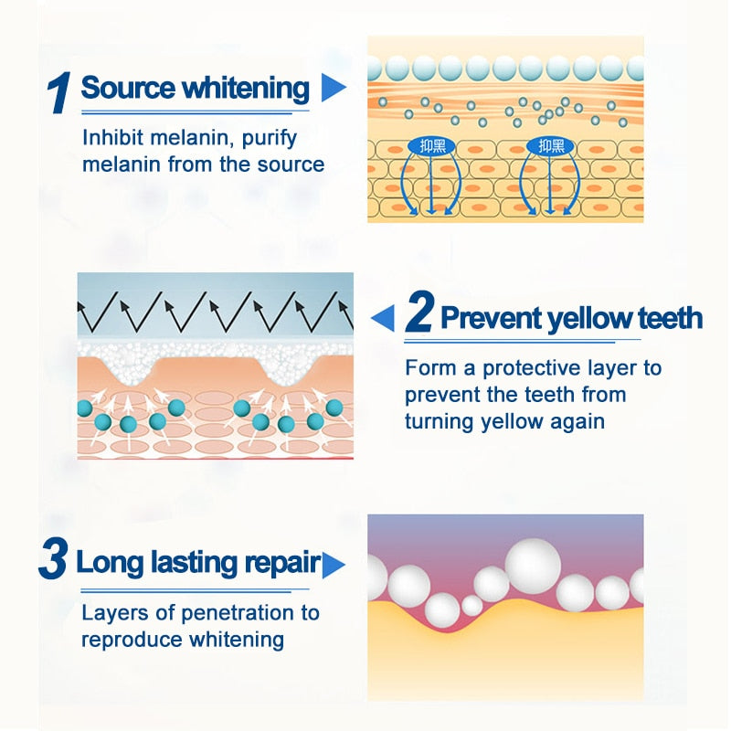 Teeth Pen Gel Removes Plaque and Stains Clean Teeth Serum